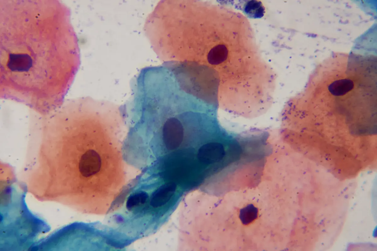 First-in-Market (Regenerative Medicine)